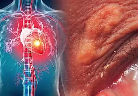 Take This Every Morning And Night, And Watch Your High Blood Pressure Completely Reversed!