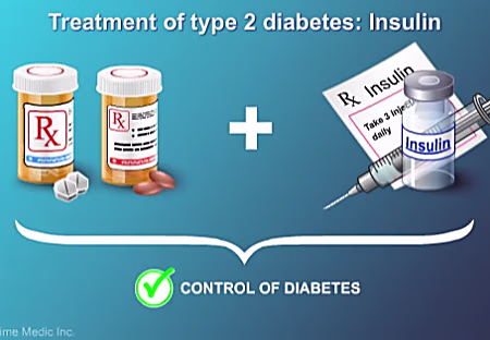 Want To Avoid Amputation Due To Diabetes? Use This Everyday