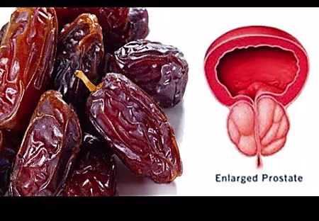 Prostate Enlargement: Proven Ancient Herbal Remedy Discovered In Ghana