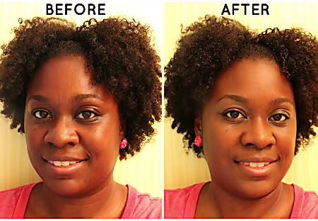 I am 53 years old, and this remedy made me a 'girl'