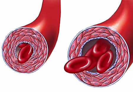 Drink this to clean blood vessels, Cardiologist's advice. Drink this to clean blood vessels, Cardiologist's advice.