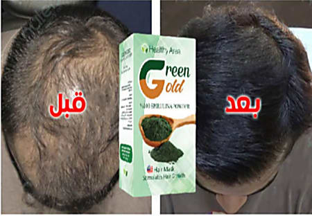 المنتج الاكثر مبيعاً في ماليزيا ومصر لتغطية فراغات الشعر وعلاج الصلع